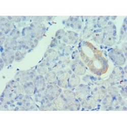 Urotensin-2 (UTS2) Antibody