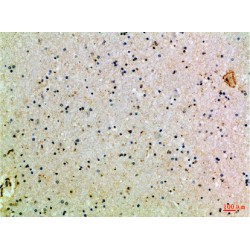 Cluster of Differentiation 24 (CD24) Antibody