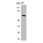 WB analysis of 293 cells, using POTEG / POTEH / POTEM Antibody.