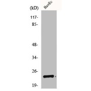 WB analysis of COLO205 cells.