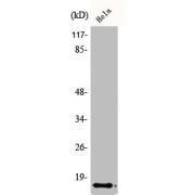 WB analysis of HeLa cells, using IAPP antibody.