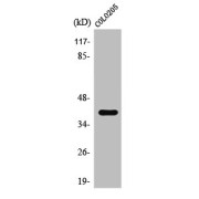 WB analysis of COLO205 cells.