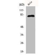 WB analysis of HeLa cells, using EPS8L2 antibody.