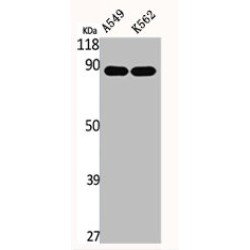 EPS8 Like 2 (EPS8L2) Antibody