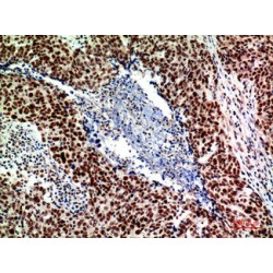 Alkaline Ceramidase 2 (ACER2) Antibody