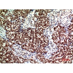 Alkaline Ceramidase 2 (ACER2) Antibody