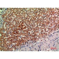 Alkaline Ceramidase 2 (ACER2) Antibody