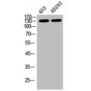 WB analysis of 453 AD293 cells, using EIF2AK3/PERK (pT981) antibody.