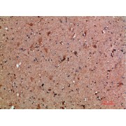 IHC analysis of paraffin-embedded human brain tissue, using CLCF1 antibody (1/200 dilution).