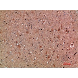 Cardiotrophin Like Cytokine Factor 1 (CLCF1) Antibody