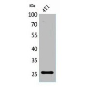 WB analysis of 4T1 cells, using CD81 antibody.