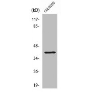 WB analysis of COLO205 cells, using ABHD6 antibody.