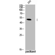 Western blot analysis of 293 cells using TPH1 pS58 Antibody.