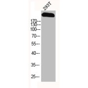 WB analysis of 293T cells, using SCN9A antibody.