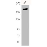 WB analysis of 293 cells.