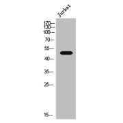 WB analysis of Jurkat cells.