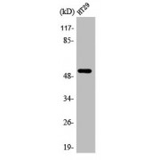 WB analysis of HT29 cells, using ADRB1 antibody.