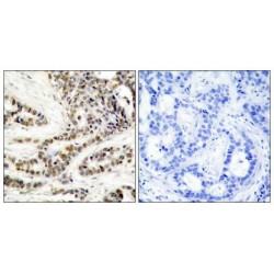 CAMP Responsive Element Binding Protein 1 Phospho-Ser129 (CREB1 pS129) Antibody