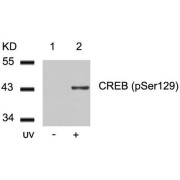 WB analysis of (1) untreated, and (2) UV-treated 293 cells.