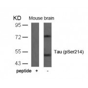 WB analysis of mouse brain tissue, using MAPT (pS214) antibody. The lane on the left contains blocking peptide.