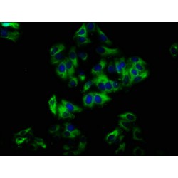 NADPH Oxidase 1 (NOX1) Antibody