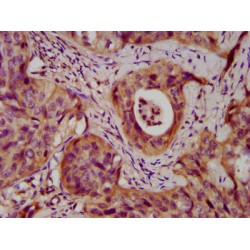 Desmocollin 3 (DSC3) Antibody