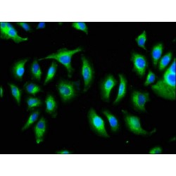 Dyslexia-Associated Protein KIAA0319 (KIAA0319) Antibody