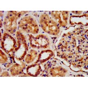 IHC-P analysis of human kidney tissue, using KIAA0319 antibody (1/500 dilution). After dewaxing and hydration, antigen retrieval was mediated by high pressure in citrate buffer (pH 6.0). The section was blocked with 10% normal goat serum for 30 min at RT. The primary antibody (1% BSA) was incubated at 4°C overnight, followed by biotin-conjugated secondary antibody and visualization using an HRP-conjugated SP system.