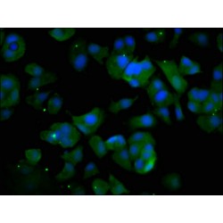 Ubiquitin Associated Protein 2 Like (UBAP2L) Antibody