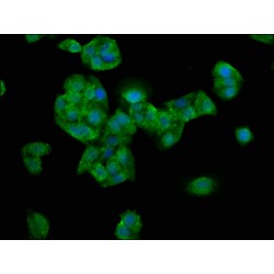 Nebulin (NEB) Antibody