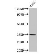 Western blot analysis of A375 whole cell lysates, using MC1R antibody (4 µg/ml). Predicted band size: 35 kDa, observed band size: 35 kDa.