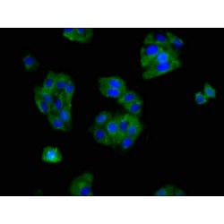 Mu-Type Opioid Receptor (OPRM1) Antibody