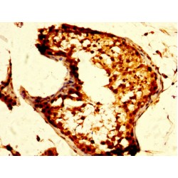 Mu-Type Opioid Receptor (OPRM1) Antibody