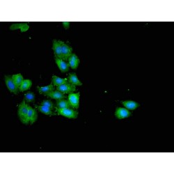 3 Beta-Hydroxysteroid Dehydrogenase Type 7 (HSD3B7) Antibody