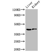 WB analysis of Mouse liver and kidney tissue, using HSD3B7 antibody (3.5 µg/ml). Predicted band size: 42, 22 kDa and Observed band size: 42 kDa.