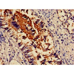 Actinin Alpha 4 (ACTN4) Antibody