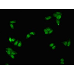 Protein C Inhibitor (SERPINA5) Antibody