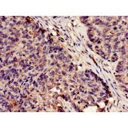 Protein C Inhibitor (SERPINA5) Antibody