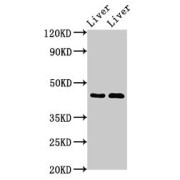 WB analysis of Rat liver tissue and Mouse liver tissue, using SERPINA5 antibody (3 µg/ml). Predicted band size: 46 kDa and Observed band size: 46 kDa.