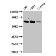 WB analysis of 293 whole cell lysate, U251 whole cell lysate and Rat kidney tissue, using EOMES antibody (4.5 µg/ml). Predicted band size: 46 kDa, 48 kDa, 73 kDa, 75 kDa and Observed band size: 73 kDa.