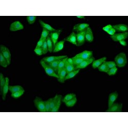 Choline Kinase Beta (CHKB) Antibody