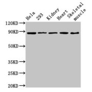 Western blot analysis of HeLa (Lane 1), 293 (Lane 2) cell lysates, Rat Kidney (Lane 3), Mouse Heart (Lane 4), Mouse Skeletal Muscle (Lane 5) tissue homogenates using SEMA3A Antibody (3.6 µg/ml) followed by Goat polyclonal Anti-Rabbit IgG (1/50000 dilution). Calculated MW: 89 kDa, Observed MW: 89 kDa.