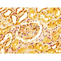 NADH Ubiquinone Oxidoreductase Core Subunit S2 (NDUFS2) Antibody