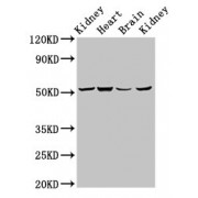 WB analysis of (1) Rat Kidney Tissue, (2) Mouse Heart Tissue, (3) Mouse Brain Tissue, and (4) Mouse Kidney Tissue, using NDUFS2 Antibody (6.9 µg/ml). Predicted band size: 52/53 kDa, Observed band size: 53 kDa.