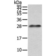 WB analysis of Human Plasma, using IGLV1-51 Antibody (1/200 dilution).