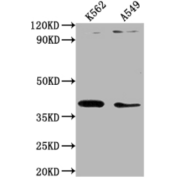 WB analysis of K652 and A549 whole cell lysate, using TMOD1 antibody (1/1000 dilution) and Goat anti-Rabbit IgG antibody (1/50000 dilution). Calculated MW: 27 kDa, 41 kDa, Observed MW: 41 kDa.