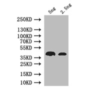 Western blot analysis of recombinant nos protein using Protein nanos (nanos) Antibody (1/1000 dilution) and Goat Anti-Rabbit IgG (1/50000 dilution).<br>Calculated MW: 38 kDa<br>Observed MW: 38 kDa
