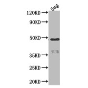 WB analysis of the recombinant protein, using rpoD antibody (1/2000 dilution). Calculated MW: 41.6 kDa, Observed MW: 48 kDa.