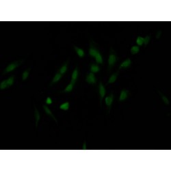 Nuclear Pore Complex Protein Nup98-Nup96 (NUP98) Antibody