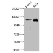 WB analysis of K-562 and HeLa cell lysates, using NUP98 antibody (1/1000 dilution). Calculated MW: 198, 188, 98, 97, 196, 187 kDa; Observed MW: 100 kDa.